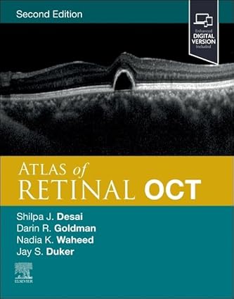 Atlas of Retinal OCT: Optical Coherence Tomography 2nd Edition